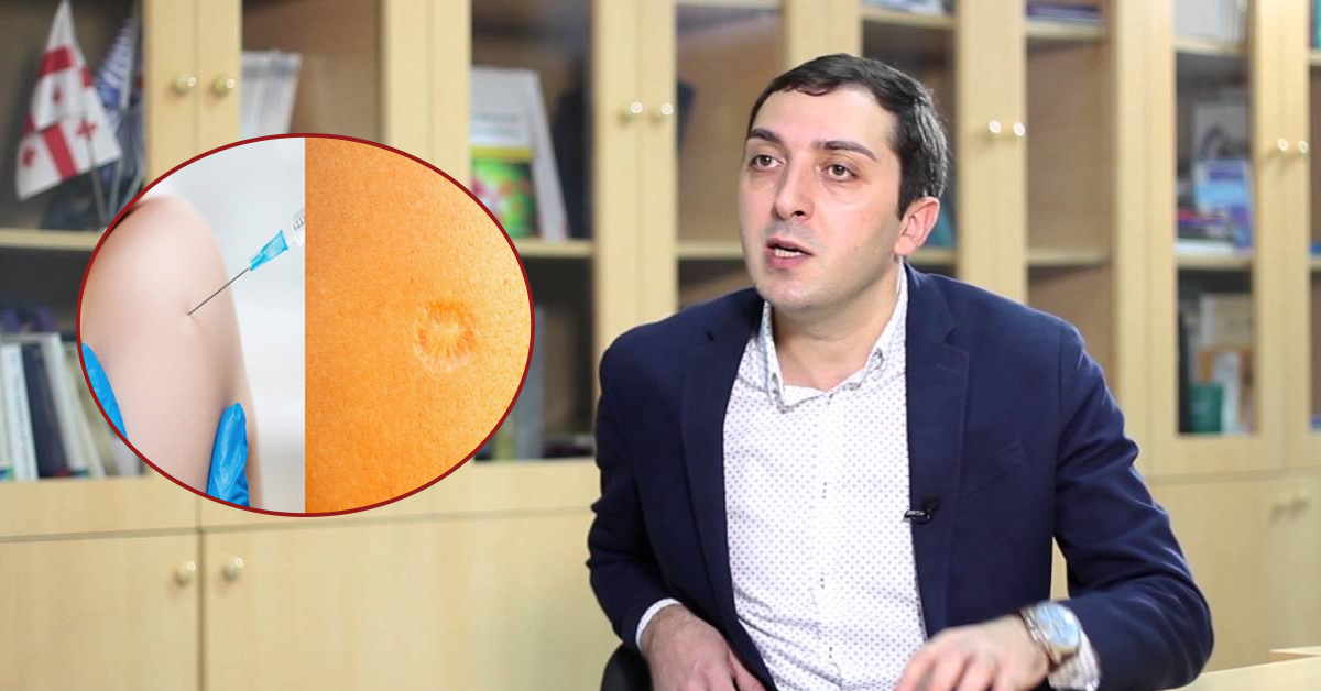 ბიძინა კულუმბეგოვი: ბეცეჟეს ვაქცინა ზოგად იმუნიტეტს ნამდვილად აძლიერებს – როგორ მოქმედებს ის კორონავირუსზე