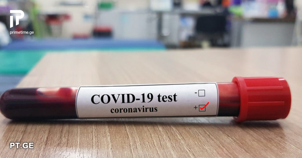 57 ინფიცირებული და 9 გამოჯანმრთელებული - საქართველოში კოვიდინფიცირების ყველაზე მაღალი მაჩვენებელი დაფიქსირდა