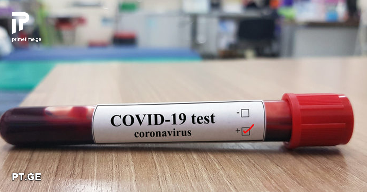 57 ინფიცირებული და 9 გამოჯანმრთელებული – საქართველოში კოვიდინფიცირების ყველაზე მაღალი მაჩვენებელი დაფიქსირდა