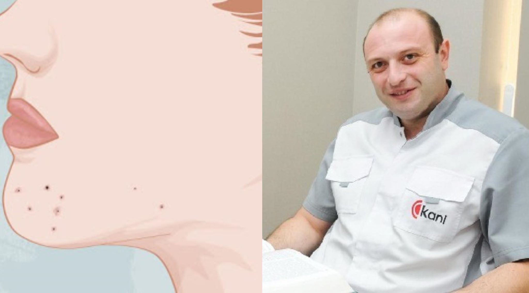 5 ტიპის გამონაყარი, რომელიც კორონავირუსით დაინფიცირებაზე მიგვანიშნებს