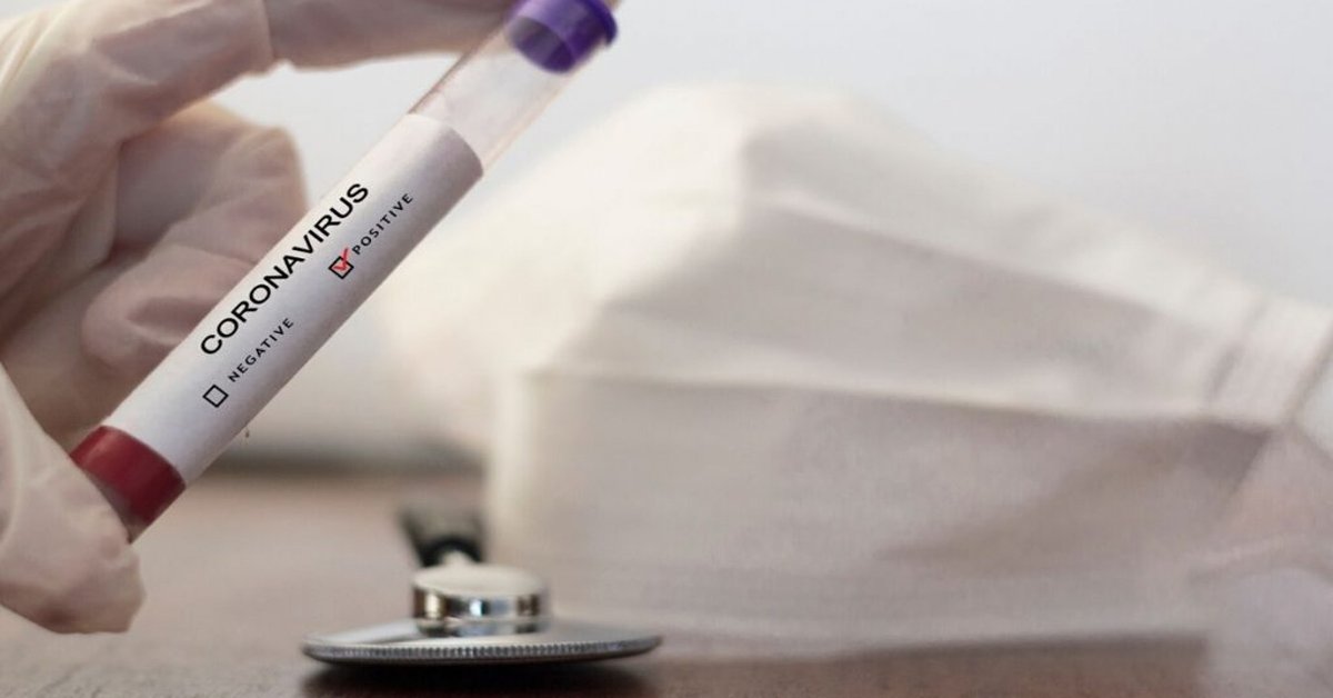 საქართველოში კორონავირუსის 9 ახალი შემთხვევა გამოვლინდა