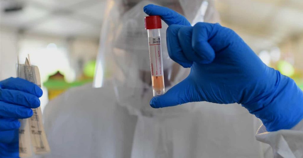 საქართველოში კორონავირუსის რეკორდული, 158 შემთხვევა დაფიქსირდა