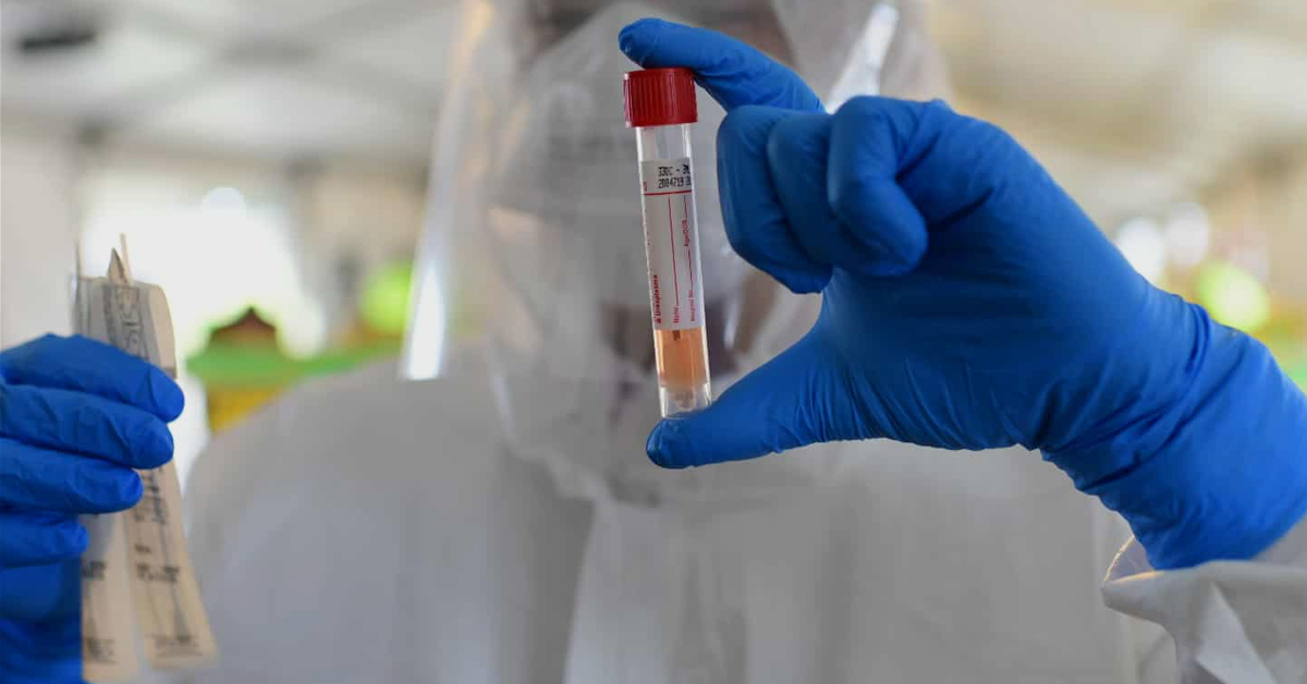 საქართველოში კორონავირუსის რეკორდული, 158 შემთხვევა დაფიქსირდა