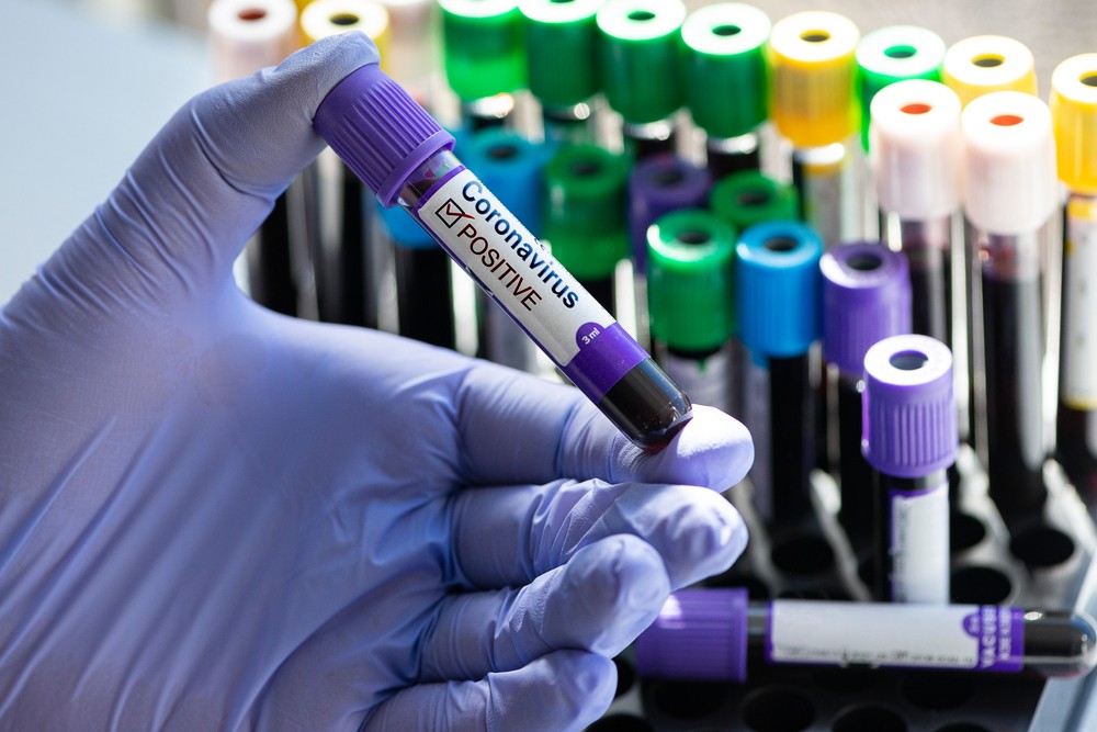 „საბურთალოს კლასტერში“ დაინფიცირებულების რიცხვი გაიზარდა