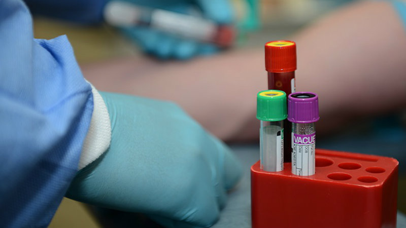 ბოლო 24 საათში უკრაინაში კორონავირუსით ინფიცირების 666 ახალი შემთხვევა დადასტურდა