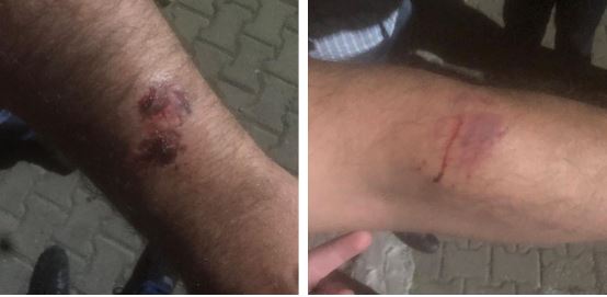 ვრცელდება კადრები - მოქალაქის დაკავებისას პოლიციელებს სიტყვიერი და ფიზიკური შეურაცხყოფა მიაყენეს