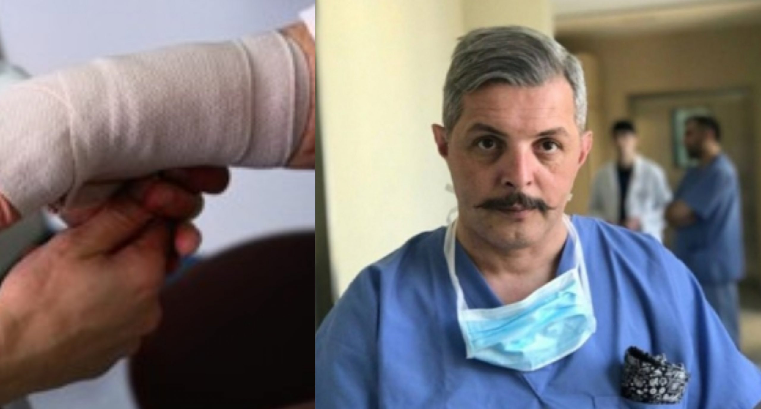 25%-ია დამწვარი! – გუგა ქაშიბაძე აფეთქების დროს დამწვარ 48 წლის მამაკაცზე