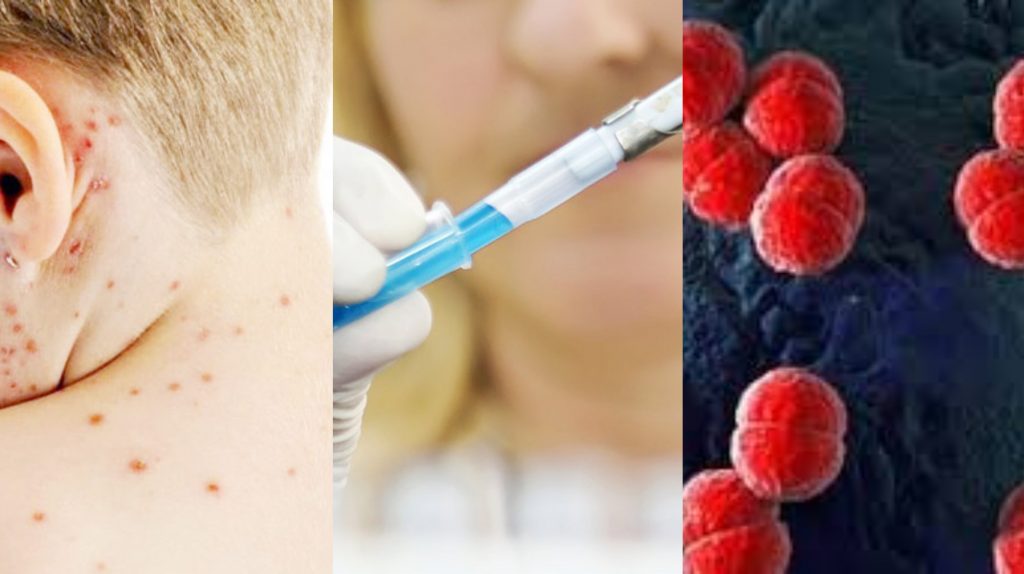 როგორ ვლინდება ბავშვებში მენინგოკოქცემია - დაავადება, რომელმაც დღეს 2 წლის ბავშვი იმსხვერპლა