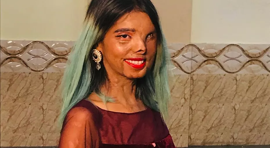 მამამ 2 თვის შვილს სასიკვდილო განაჩენი გამოუტანა. გოგონა გადარჩა და... - ისტორია, რომელმაც მსოფლიო შეძრა