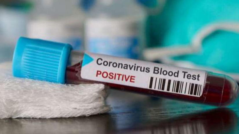 ბოლო 24 საათში საქართველოში კორონავირუსით 74 ადამიანი გარდაიცვალა – ნახეთ, რამდენია ინფიცირებული