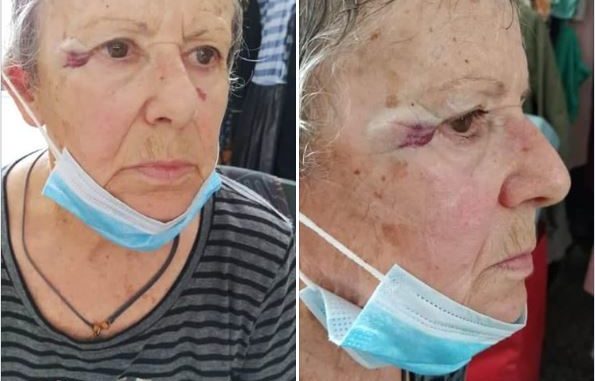 მღვდელმა მოხუცი ქალი სცემა, რადგან ეკლესიასთან კნუტებს აპურებდა – (საბერძნეთი)