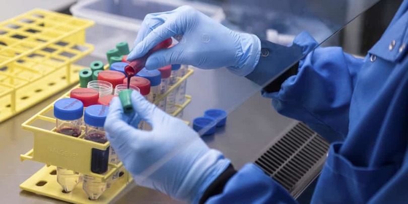 ნახეთ, სად, რა ფასად შეგიძლიათ გაიკეთოთ PCR ტესტი