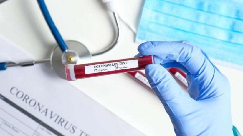 18 დეკემბერს საქართველოში კორონავირუსით 2 635 ადამიანი დაინფიცირდა, ხოლო გარდაიცვალა 49