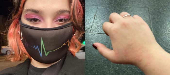 უკნიდან მეცნენ, თავში ბოთლი ჩამარტყეს, ყური მომაგლიჯეს – რა შეემთხვა ახალგაზრდა გოგონას რუსთაველზე