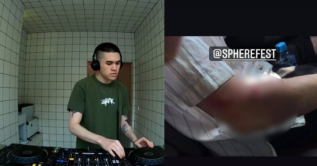 ბათუმში თავს დამესხნენ! - გერმანელი დიჯეი