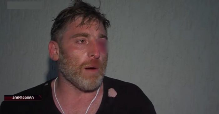 ბრბო ამოვიდა, ჟურნალისტს თმებში წვდნენ – დაშავებული ოპერატორი (ვიდეო)