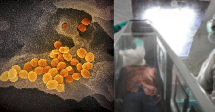 „ომიკრონს“ უკვე „ებოლას“ ვირუსს ადარებენ – რას ამბობს მსოფლიოს ექიმთა ასოციაციის ხელმძღვანელი