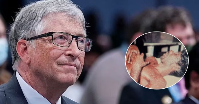 „დაიწყეთ მზადება ახალი პანდემიისთვის“ – ტერორისტები ეცდებიან გამოიყენონ ჩუტყვავილა როგორც ბილიოგიური იარაღი