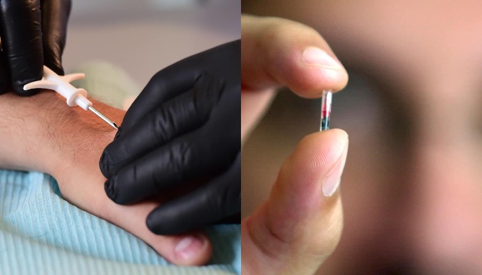 „დაჩიპვის შემდეგ შეძლებთ ყველა კარის გაღებას“ - 50 ათასი კანქვეშა ჩიპი საქართველოში იანვარში შემოვა