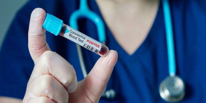 ინფიცირების 2 103 ახალი შემთხვევა, გარდაიცვალა კიდევ 60 პაციენტი – განახლებული სტატისტიკა